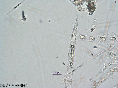 phyto/Scattered_Islands/all/COMMA April 2011/Rhizosolenia hebetata (ancien R. sp2 -ancien R. sp6 recomposé)(copy)_thumb.jpg